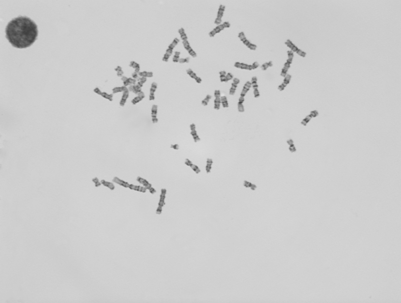 用MTR3CCD拍摄染色体图像